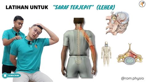 Cara Mengatasi Saraf Terjepit Pd Leher Cervical Root Syndrome