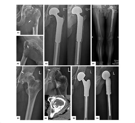 Main Indications And Typical Preoperative And Postoperative