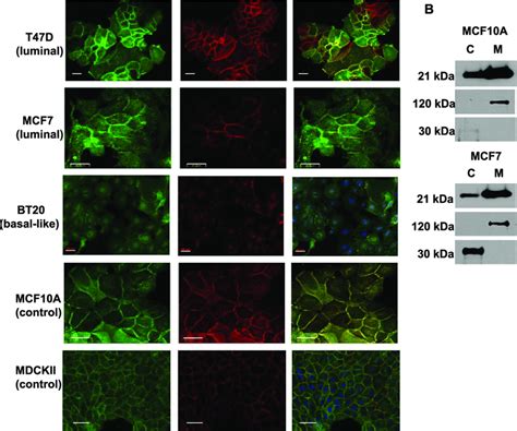 Subcellular Localization Of Claudin 1 In Human Breast Cancer Cell