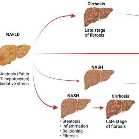 NAFLD development and progression. NAFLD develops from a healthy liver... | Download Scientific ...