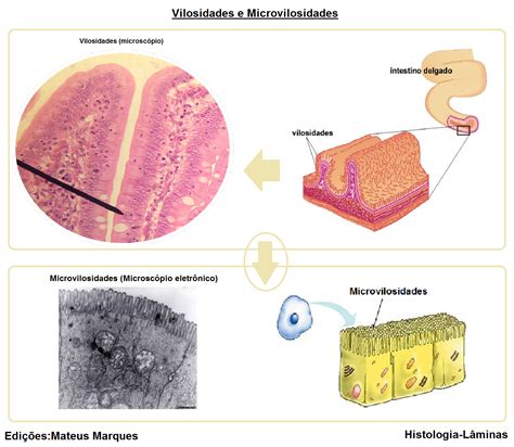 Doença De Inclusão Das Microvilosidades Expectativa De Vida - Vilosidades e Microvilosidades