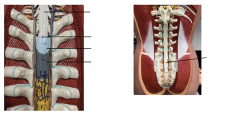 Meninges Diagram Quizlet