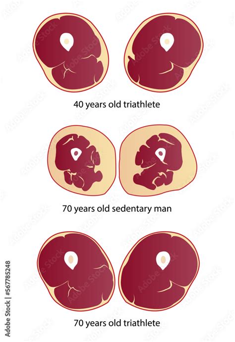 Comparison of muscle mass and strength vector illustration isolated on ...