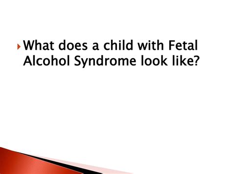 Ppt Fetal Alcohol Syndrome Powerpoint Presentation Free Download Id 9226639