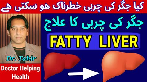 Fatty Liver Treatment In Urdu Hindi Jigar Ki Charbi Ka Ilaj Fatty