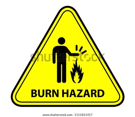 Yellow Warning Triangle Sign Burn Hazard Stock Vector Royalty Free