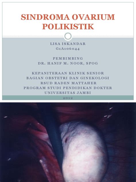 Sindroma Ovarium Polikistik Pdf