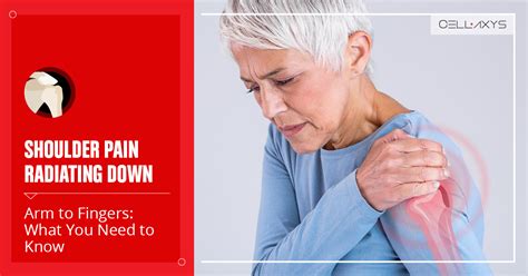 Shoulder Pain Radiating Down Arm To Fingers What You Need To Know