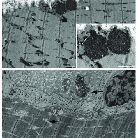 Electron microscopy of muscle fibers in longitudinal section of three... | Download Scientific ...