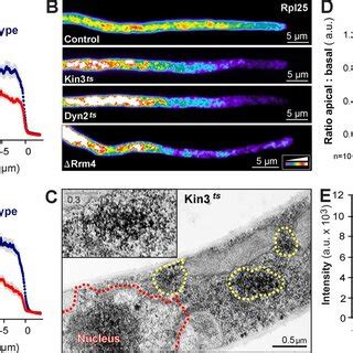 The Role Of Kinesin Dynein And Rrm In Distributing Ribosomes A