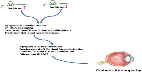 Antioxidants Free Full Text Diabetic Retinopathy Are Lncrnas New