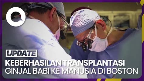 Tim Bedah Di Boston Berhasil Transplantasi Ginjal Babi Ke Manusia