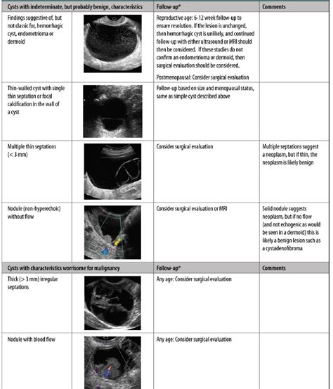 Ovarian Cyst F U Guideline Radiology World