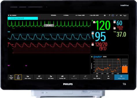 Vital Sign Display HeRO ES Medical Predictive Science Corporation