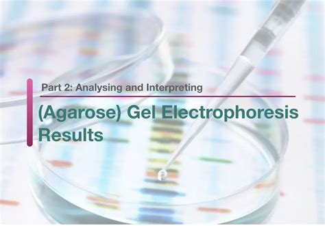 Part 2: Analysing and Interpreting (Agarose) Gel Electrophoresis Results