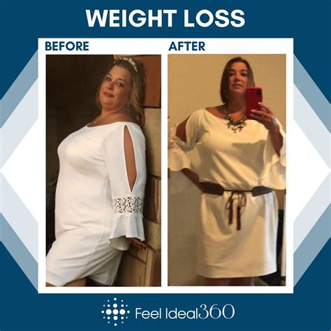 Weight Loss Before And Afters Feel Ideal 360 Med Spa Southlake TX