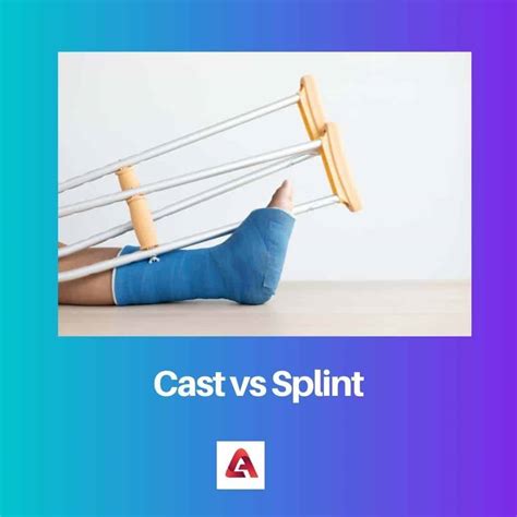 Cast Vs Splint Difference And Comparison