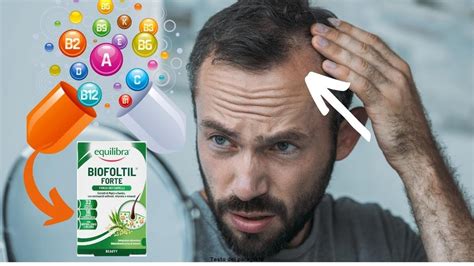 Caduta Dei Capelli QUESTO INTEGRATORE E IL MIGLIORE PER PREZZO E