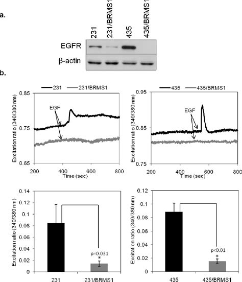 Figure 11 From The Role Of Phosphoinositide Signaling In Breast Cancer