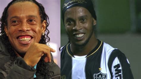 Smile Big Ronaldinho Fixes His Teeth Nbc Sports