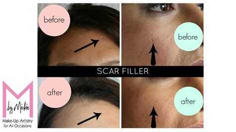 Scar Filler Under Makeup Saubhaya Makeup