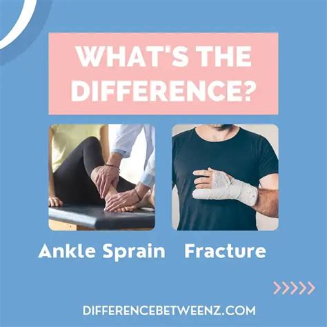 Difference Between Ankle Sprain And Fracture Difference Betweenz