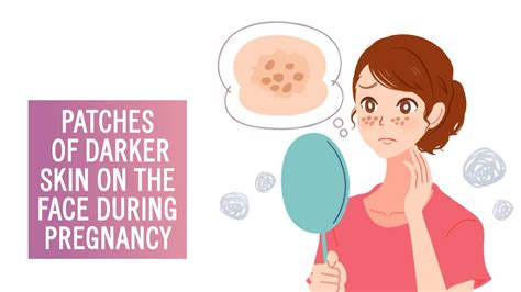 Itchy Skin During Pregnancy