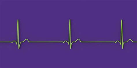 Detailed Illustration Electrocardiogram Displaying Sinus Bradycardia