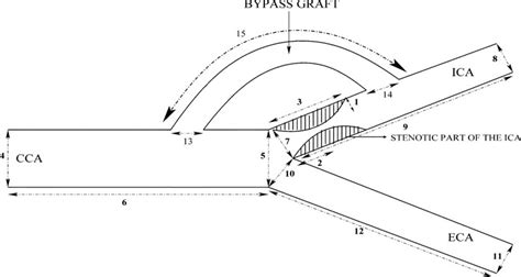 Schematic Of The One Dimensional Human Carotid Artery Bifurcation With Download Scientific