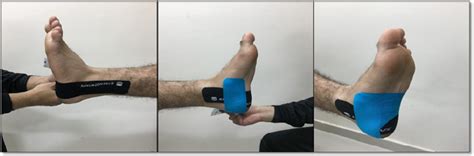 [pdf] The Effect Of Kinesio Taping On Balance Control And Functional