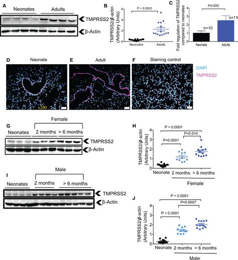 Frontiers Differential Effects Of Age Sex And Dexamethasone Therapy On Ace2 Tmprss2