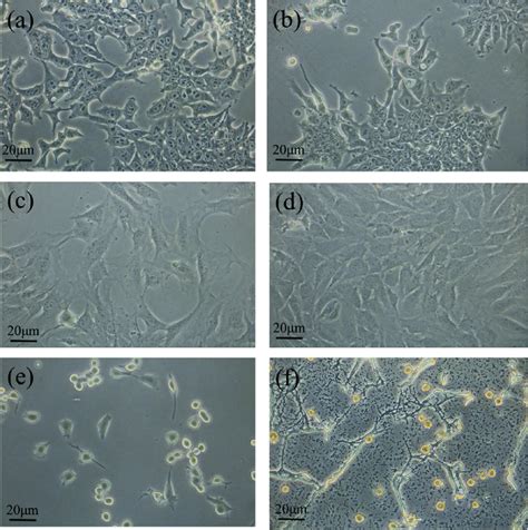 Images Of Cell Adhesion And Proliferation Of P Mouse Teratocarcinoma