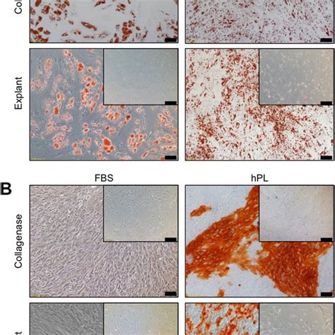 Differentiation Of Hadsc In The Four Different Conditions A Pictures