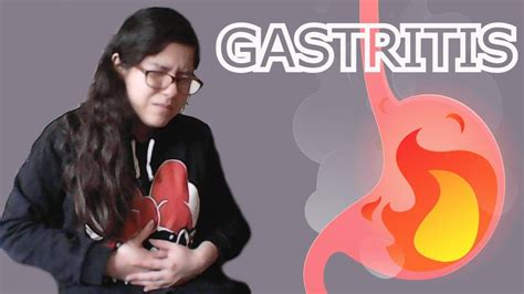 Qu Comer Y Qu Evitar Si Tengo Gastritis C Mo Prevenirla Youtube