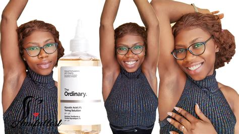 HOW TO GET LIGHTER ARMPITS FAST The Ordinary Glycolic Acid 7 Toning