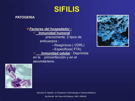 Sifilis Revision Ppt Listo Sifilis Tratamiento PPT Descarga Gratuita