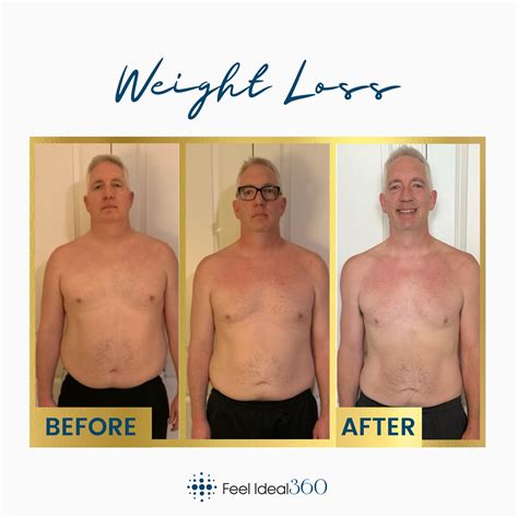 Before After WEIGHT LOSS Feel Ideal 360 In Southlake Tx Feel Ideal