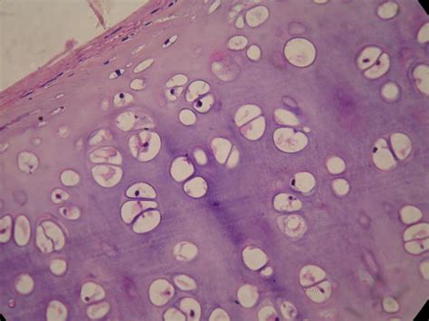 BiologÍa Tejido Cartilaginoso Y Óseo