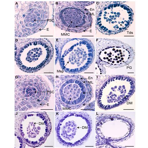 Microsporogenesis Is Arrested In Ms5 B Ms5 B Download Scientific