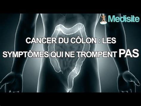 Cancer Du C Lon Les Sympt Mes Qui Ne Trompent Pas Youtube