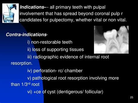 Pediatric Endodontics