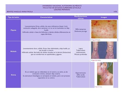 Cuadro Lesiones Primarias Anna Paola Benitez Udocz