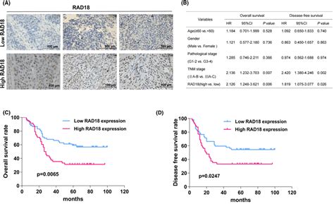 Elevated Rad Expression In Esophageal Squamous Cell Carcinoma Escc