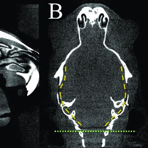 Sagittal A And Transversal B Reconstruction Of A Micro Ct Image Download Scientific Diagram