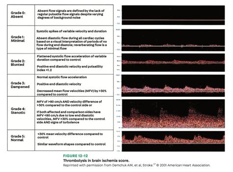 MedClub On Twitter RT CarlosJMoreno Review Neurology POCUS