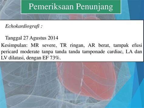 Penyakit Jantung Rematik