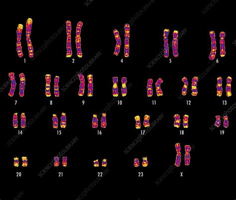 Human female karyotype - Stock Image - C001/8379 - Science Photo Library