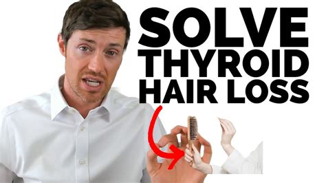 Stop Thyroid Hair Loss Treatments That Work Quickly Youtube