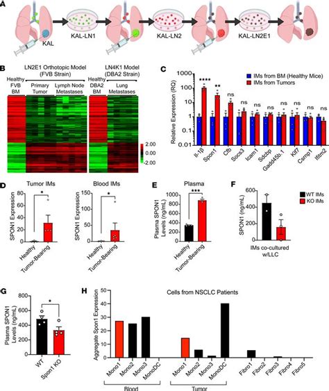 JCI Insight Spon1 Inflammatory Monocytes Promote Collagen Remodeling