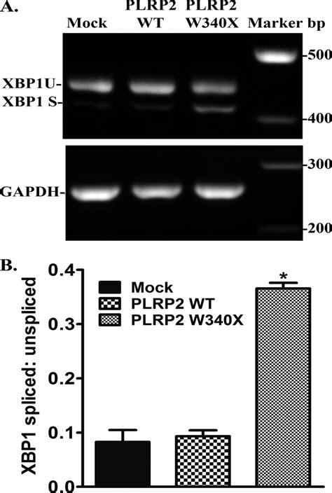 Xbp Mrna Splicing In Hek T Cells Expressing Wild Type Or W X